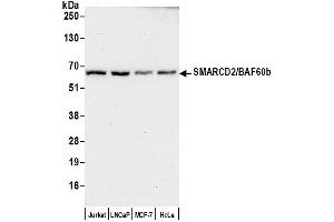 anti-SWI/SNF Related, Matrix Associated, Actin Dependent Regulator of Chromatin, Subfamily D, Member 2 (SMARCD2) (AA 425-475) antibody