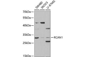 Western blot analysis of extracts of various cell lines, using RC antibody (ABIN6129452, ABIN6146811, ABIN6146812 and ABIN6220955) at 1:1000 dilution. (RCAN1 antibody  (AA 60-245))