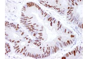 Immunohistochemistry (IHC) image for anti-Protein Kinase, DNA-Activated, Catalytic Polypeptide (PRKDC) (AA 2100-2150) antibody (ABIN7448533)