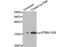 Western Blotting (WB) image for anti-Stathmin 1 (STMN1) (pSer25) antibody (ABIN1870654) (Stathmin 1 antibody  (pSer25))