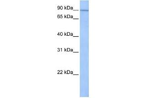 UNC84A antibody used at 1 ug/ml to detect target protein.