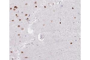 ABIN6266529 at 1/100 staining human brain tissue sections by IHC-P. (DP1 antibody  (C-Term))