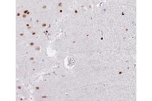 ABIN6266529 at 1/100 staining human brain tissue sections by IHC-P. (DP1 antibody  (C-Term))