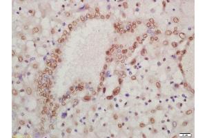 Formalin-fixed and paraffin embedded human placenta labeled with Rabbit Anti-HOXA13 Polyclonal Antibody, Unconjugated  at 1:200 followed by conjugation to the secondary antibody and DAB staining