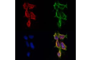 ABIN6262174 and ABIN6269018 staining HepG2 by IF/ICC. (HDAC10 antibody  (N-Term))