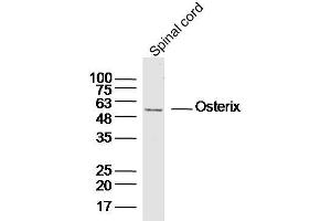 Mouse spinal cord lysates probed with Osterix Polyclonal Antibody, unconjugated  at 1:300 overnight at 4°C followed by a conjugated secondary antibody for 60 minutes at 37°C. (SP7 antibody  (AA 331-431))