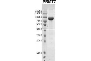 Recombinant PRMT7 protein gel.