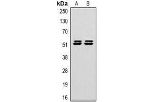 Western blot analysis of Carbonic Anhydrase 9 expression in Hela (A), 293T (B) whole cell lysates. (CA9 antibody)