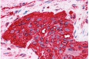 HumanColon, myenteric plexus: Formalin-Fixed, Paraffin-Embedded (FFPE) (alpha Tubulin antibody)