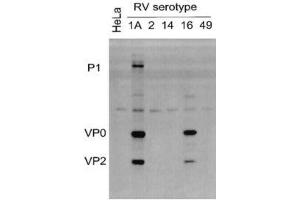 Lysates of HeLa cells infected with RV serotypes 1A, 2, 14, 16 or 49 and blotted with ABIN1000236 (Rhinovirus 16 antibody)