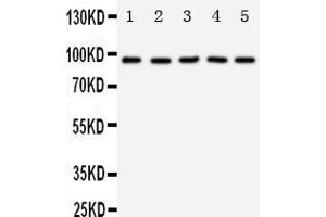 Anti-TrkC antibody, Western blotting Lane 1: Rat Brain Tissue Lysate Lane 2: Mouse Brain Tissue Lysate Lane 3: U87 Cell Lysate Lane 4: SHG Cell Lysate Lane 5: NEURO Cell Lysate (NTRK3 antibody  (N-Term))