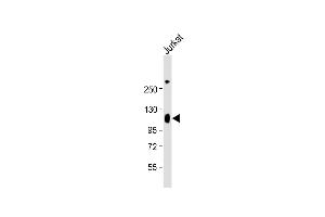 Anti-LP2 Antibody (Center) at 1:2000 dilution + Jurkat whole cell lysate Lysates/proteins at 20 μg per lane. (LAMP2 antibody  (AA 196-225))