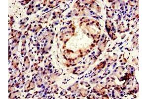 Immunohistochemistry of paraffin-embedded human pancreatic tissue using ABIN7147925 at dilution of 1:100 (CPSF6 antibody  (AA 186-226))