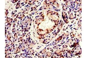 Immunohistochemistry of paraffin-embedded human pancreatic tissue using ABIN7147925 at dilution of 1:100