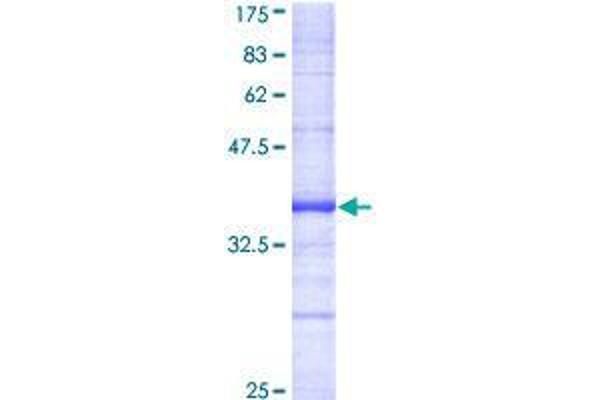 DAPK2 Protein (AA 281-370) (GST tag)