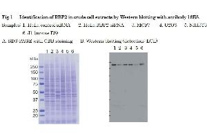 KDM5A antibody  (AA 1416-1434)