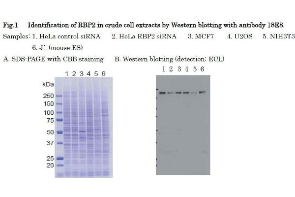 KDM5A antibody  (AA 1416-1434)