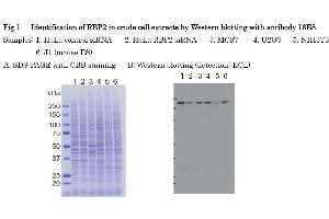 Western Blotting (WB) image for anti-Lysine (K)-Specific Demethylase 5A (KDM5A) (AA 1416-1434) antibody (ABIN3201015) (KDM5A antibody  (AA 1416-1434))