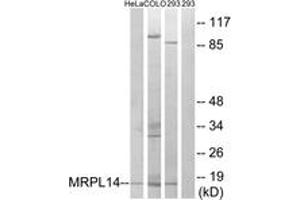 Western Blotting (WB) image for anti-Mitochondrial Ribosomal Protein L14 (MRPL14) (AA 96-145) antibody (ABIN2890048) (MRPL14 antibody  (AA 96-145))