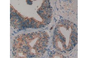 Used in DAB staining on fromalin fixed paraffin- embedded prostate gland tissue (COL6 antibody  (AA 1-336))