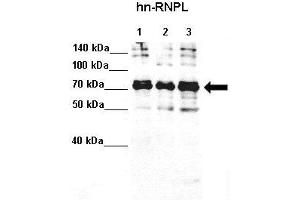 Lanes :  Lane 1: 20ug HeLa S3 lysate Lane 2: 20ug MCF7 lysate Lane 3: 20ug K562 lysate   Primary Antibody Dilution :   1:4000    Secondary Antibody :  Anti-rabbit-HRP   Secondary Antibody Dilution :   1:5000   Gene Name :  HNRPL   Submitted by :  Anonymous