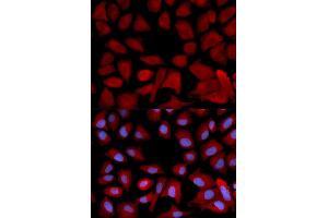 Immunofluorescence analysis of U2OS cell using PSMC4 antibody. (PSMC4 antibody  (AA 1-165))