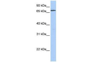 WB Suggested Anti-ZNF548 Antibody Titration:  0. (ZNF548 antibody  (N-Term))