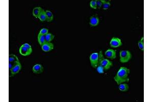 Immunofluorescent analysis of MCF-7 cells using ABIN7165366 at dilution of 1:100 and Alexa Fluor 488-congugated AffiniPure Goat Anti-Rabbit IgG(H+L) (FAM118A antibody  (AA 51-357))