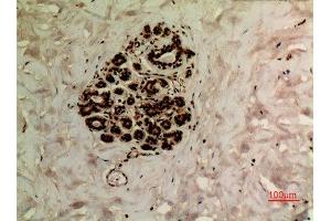 Immunohistochemistry (IHC) image for anti-Ubiquitin (Ub) (acLys27) antibody (ABIN3181496)