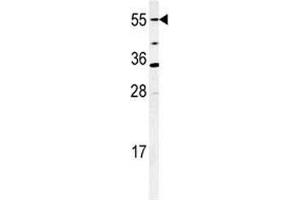 Western blot analysis of CYP26A1 antibody and mouse NIH3T3 cell lysate. (CYP26A1 antibody  (AA 467-497))
