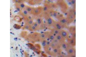 Used in DAB staining on fromalin fixed paraffin-embedded Liver tissue (IL17C antibody  (AA 36-187))