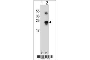 Western blot analysis of GADD45A using rabbit polyclonal GADD45A Antibody using 293 cell lysates (2 ug/lane) either nontransfected (Lane 1) or transiently transfected (Lane 2) with the GADD45A gene.