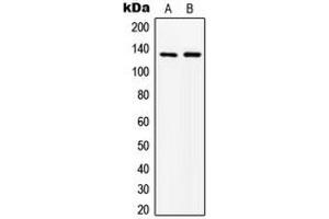Western blot analysis of ABL1 expression in MCF7 (A), HepG2 (B) whole cell lysates. (ABL1 antibody  (N-Term))