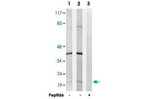Western blot analysis of extracts from K-562 cells (Lane 1) and Jurkat cells (Lane 2 and lane 3), using C6orf108 polyclonal antibody . (RCL antibody)
