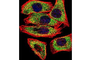Fluorescent confocal image of  cell stained with TGM2 Antibody (Center ) (ABIN392285 and ABIN2841950). (Transglutaminase 2 antibody  (AA 429-458))