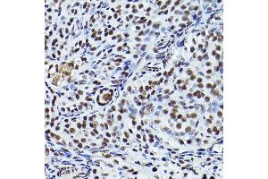 Immunohistochemistry of paraffin-embedded rat ovary using Phospho-ATR-T1989 Rabbit pAb (ABIN7265777) at dilution of 1:200 (40x lens). (ATR antibody  (pThr1989))