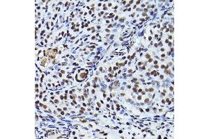 Immunohistochemistry of paraffin-embedded rat ovary using Phospho-ATR-T1989 Rabbit pAb (ABIN7265777) at dilution of 1:200 (40x lens).