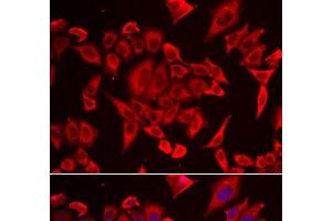 SLC20A2 antibody