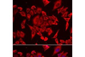 Immunofluorescence analysis of HeLa cells using SLC20A2 Polyclonal Antibody (SLC20A2 antibody)
