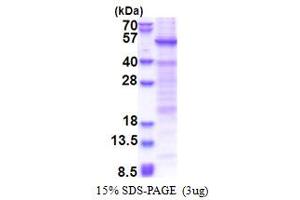 SDS-PAGE (SDS) image for Heat Shock Transcription Factor, Y-Linked 1 (HSFY1) (AA 1-401) protein (His tag) (ABIN5853436)