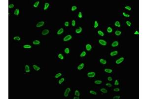 Immunofluorescence staining of Hela cells (treated with 30mM sodium butyrate for 4h) with ABIN7139161 at 1:5, counter-stained with DAPI. (Histone H2B antibody  (acLys15))