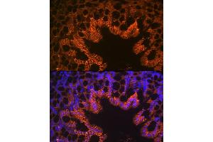 Immunofluorescence analysis of mouse large intestine using LI Cadherin/Cadherin-17 Rabbit mAb (ABIN7268249) at dilution of 1:100 (40x lens). (LI Cadherin antibody)