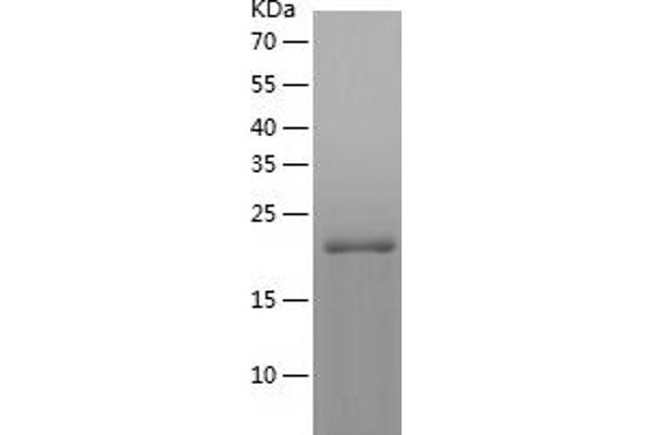 CRYGD Protein (AA 1-174) (His tag)