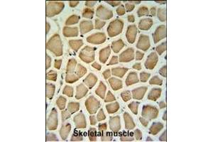 Calponin-3 Antibody (N-term) (ABIN390503 and ABIN2840859) IHC analysis in formalin fixed and paraffin embedded human skeletal muscle tissue followed by peroxidase conjugation of the secondary antibody and DAB staining. (CNN3 antibody  (N-Term))