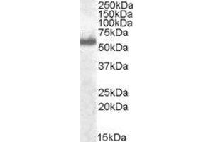 Western Blotting (WB) image for Interferon Regulatory Factor 5 (IRF5) peptide (ABIN369637) (Interferon Regulatory Factor 5 (IRF5) Peptide)