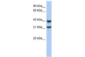Western Blotting (WB) image for anti-Chromosome 5 Open Reading Frame 35 (C5orf35) antibody (ABIN2459640) (C5orf35 antibody)