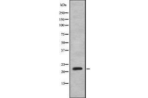 Western blot analysis IFNA8 using K562 whole cell lysates (IFNA8 antibody  (Internal Region))