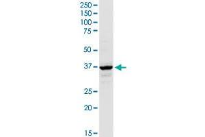 AACS MaxPab rabbit polyclonal antibody. (AACS antibody  (AA 1-410))