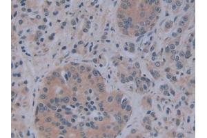 Immunohistochemistry (IHC) image for anti-Alkaline Phosphatase, Liver/bone/kidney (ALPL) (AA 18-335) antibody (ABIN7433150)