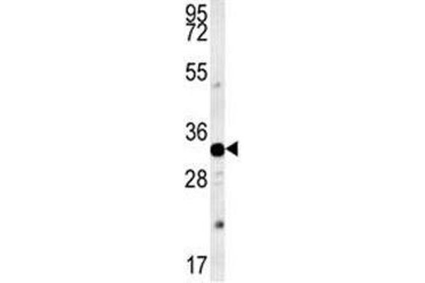 AQP11 anticorps  (AA 244-271)